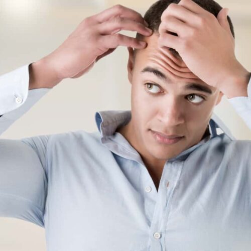 Hair Transplant – Procedure, Cost, and Factors to Consider